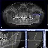 لوگوی دکتر فرزانه مومنی - رادیولوژی دهان و دندان