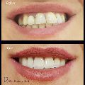 لوگوی دکتر مجید جعفری - دندانپزشک